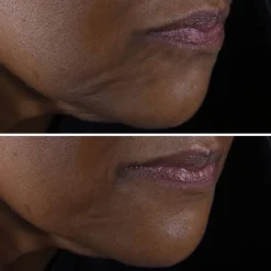 CLINIQUESmart Clinical Repair™ Crème Liftante Visage + Cou