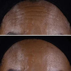 CLINIQUESmart Clinical Repair™ Crème Liftante Visage + Cou