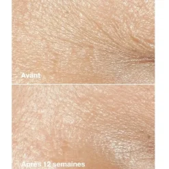 CLINIQUESmart Clinical Repair                Crème Riche Correctrice Anti-rides