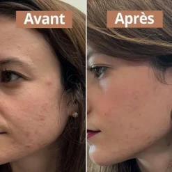 Comme AvantSérum Anti-Imperfections Soin Visage